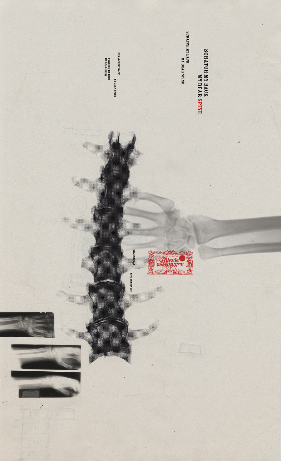 My dear spine